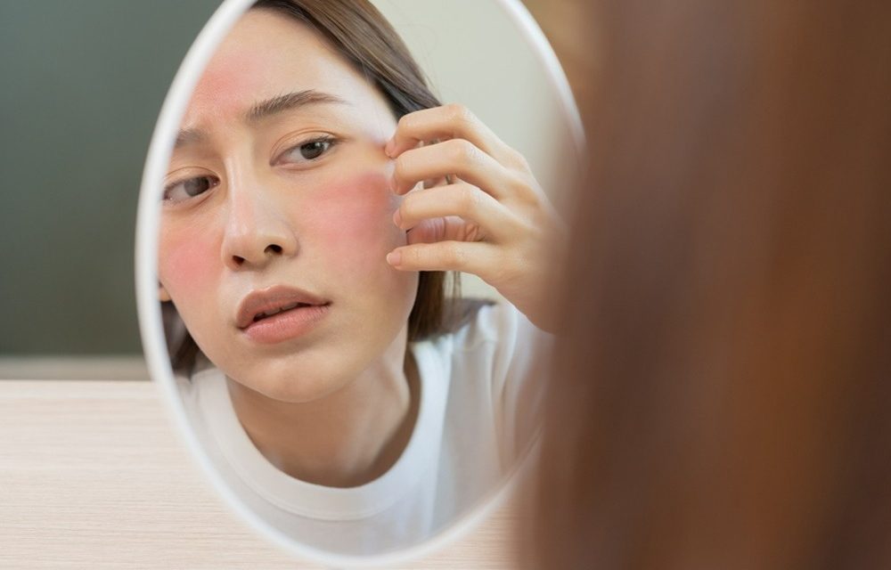 Waspada Skincare Viral, Ini Ciri-Ciri Kulit Alami Over-Exfoliation