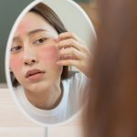 Waspada Skincare Viral, Ini Ciri-Ciri Kulit Alami Over-Exfoliation