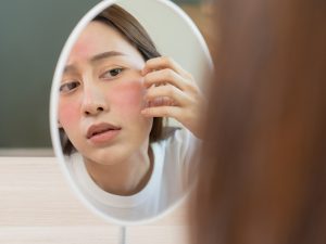 Waspada Skincare Viral, Ini Ciri-Ciri Kulit Alami Over-Exfoliation
