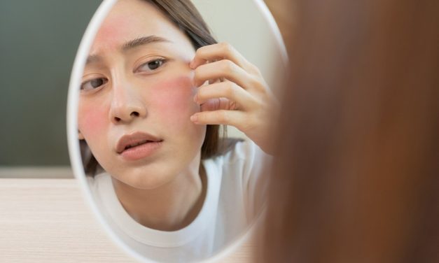 Waspada Skincare Viral, Ini Ciri-Ciri Kulit Alami Over-Exfoliation